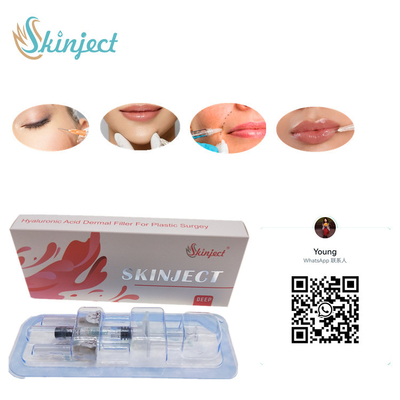 تزریقی Skinject Deep HA پوستی 2ml فیلر لب گونه چین نازولابیال چانه
