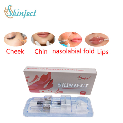 تزریقی Skinject Deep HA پوستی 2ml فیلر لب گونه چین نازولابیال چانه