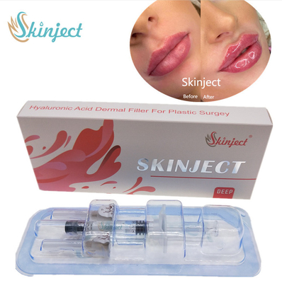 تزریقی Skinject Deep HA پوستی 2ml فیلر لب گونه چین نازولابیال چانه