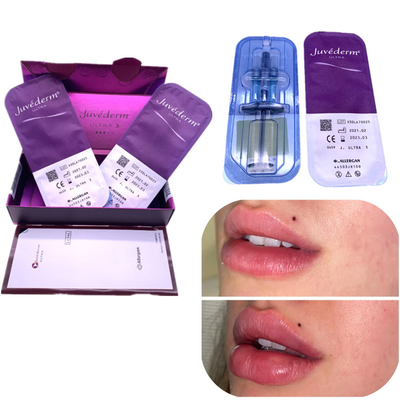 تزریقی ها فیلر Juvederm 2x1ml تقویت کننده لب رفع چین و چروک