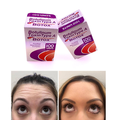 100 IU Allergan  Botulinum Toxin نسخه انگلیسی