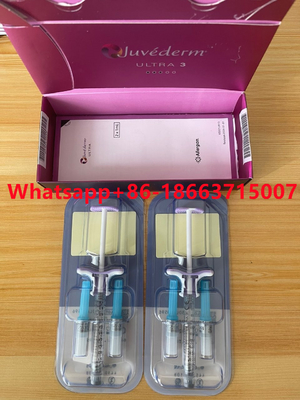 تزریق فیلر پوستی Juvederm Ultra3 Ultra4 برای رفع چین و چروک لب