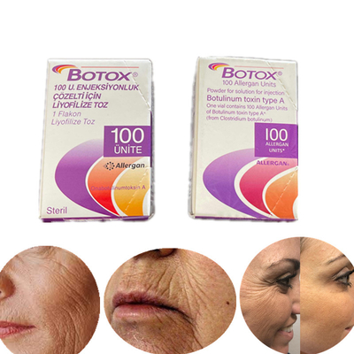 نسخه انگلیسی نوع A Botulinum Toxin 100 Iu Allergan  for Wrinkles
