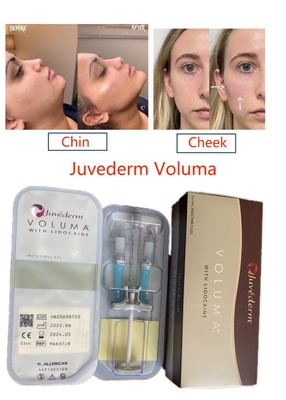 پرکننده اسید هیالورونیک متقاطع Juvederm Voluma با ماندگاری طولانی صورت خالص تزریقی