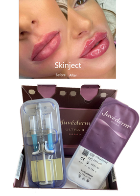 فیلر پوستی هیالورونیک اسید Juvederm Reshape Lips Reshape Lido Ultra4 2X1ml