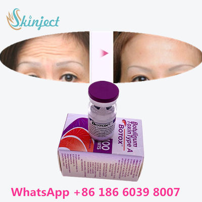 سم بوتولینوم بوتاکس رفع چین و چروک 100u Allergan 100 واحد برای تزریق لیفت صورت