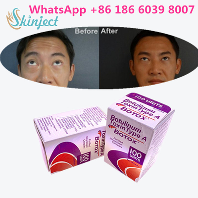 Botulinum Toxin Allergan s 1x100iu برای چین و چروک صورت