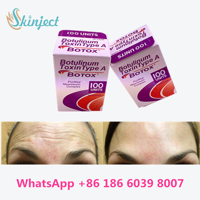 Botulinum Toxin Allergan  100 Iu 200ui 1 Vial / Box