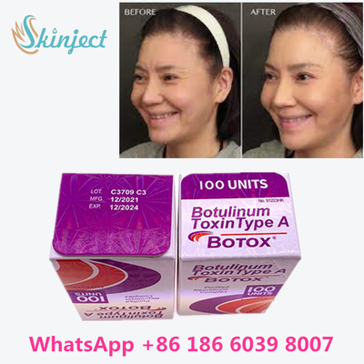 Botulinum Toxin Allergan  100 Iu 200ui 1 Vial / Box