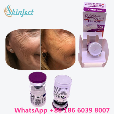 Botulinum Toxin Allergan  Type A 100 units 1 Vial / Box Packing