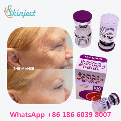 Botulinum Toxin Allergan  Type A 100 units 1 Vial / Box Packing