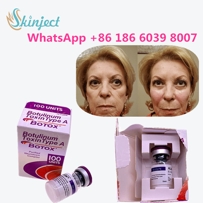 بوتاکس 100u 100% سم بوتولینوم اورجینال برای رفع چین و چروک