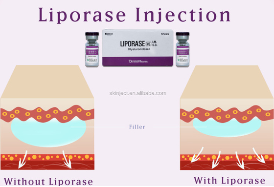 10 Vias Liporase Hyaluronidase برای پرکننده پوست برای حل شدن