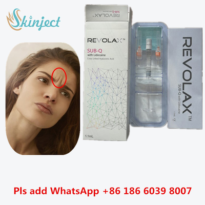 فیلر پوستی هیالورونیک اسید Revolax Fine برای چین و چروک صورت