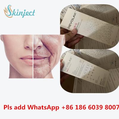 تزریقات هیالورونیک اسید صورت Revolax Deep Filler Sub-Q Cross Linked