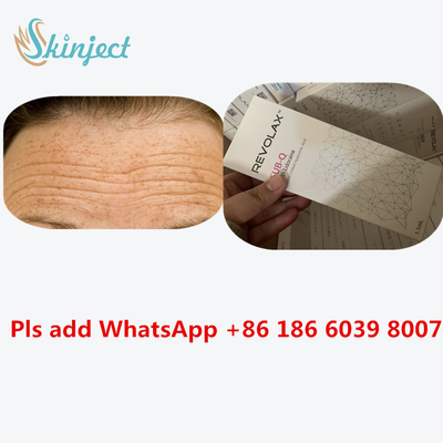 تزریقات هیالورونیک اسید صورت Revolax Deep Filler Sub-Q Cross Linked