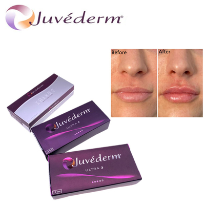 پرکننده پوست اسید هیلورونیک پریمیوم Juvederm HA پرکننده صورت Ultra3 Ultra4 حجم برای جوانسازی صورت