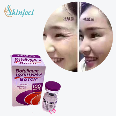 100 واحد سم بوتولینوم نوع A 2 - 8 درجه سانتی گراد دمای نگهداری