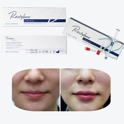 Juvederm Cross Linked Injectable Dermal Filler برای لب ها