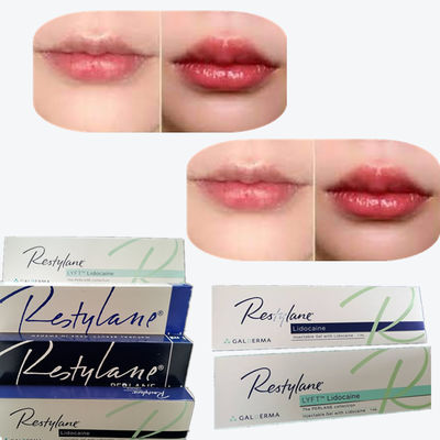 2*1ml/ Box Hyaluronic Acid Dermal Filler برای افزایش لب ها