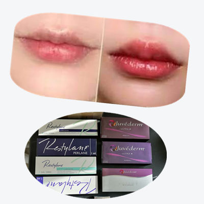 2*1ml/ Box Cross Linked Dermal Filler برای افزایش لب ها