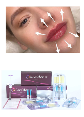 Juvederm' Hyaluronic Acid Dermal Filler Ultra3 Ultra4 حجم تزریق برای پر کردن لب