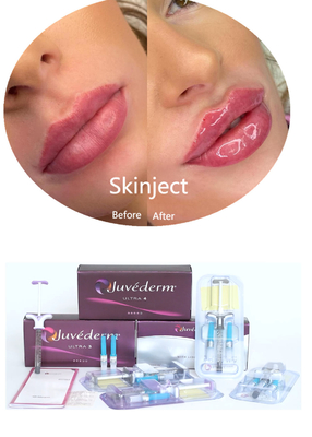 Juvederm Hyaluronic Acid Facial Dermal Filler برای تزریق 2*1ml بسته بندی