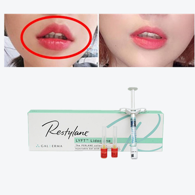 Cross Linked Dermal Filler Juvederm Lips Filler for Breast Injection
