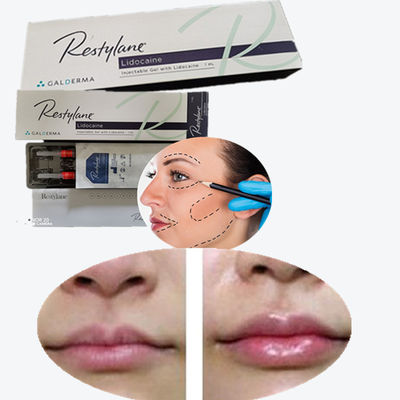 Hyaluronic Acid Pen Filler Juvederm Facial Cross Linked Dermal Filler