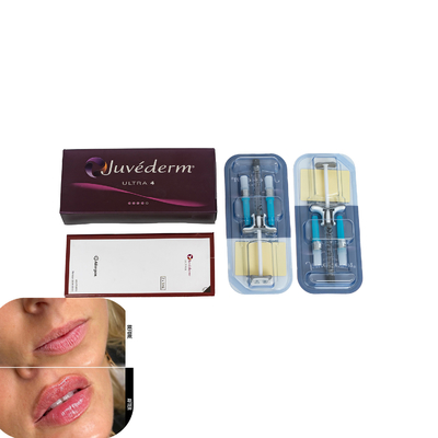 Juvederm پرکننده پوست برای لب های تزریقی پرکننده اسید هیالورونیک