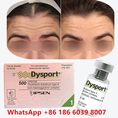تزریق Dysport Botulinum Toxin تزریق بوتاکس برای چین و چروک های گوشه دهان