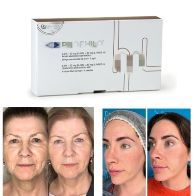 سوزن بلند کننده 5 نقطه ای Lift Profhilo Filler