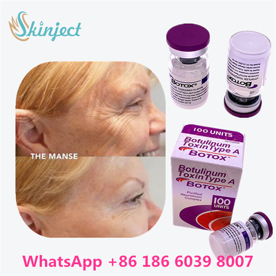 توکسین بوتولینوم بوتاکس لوازم آرایشی 100 واحد آلرژن OnabotulinumtoxinA برای چین و چروک صورت