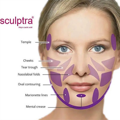 پودر CE  PLLA برای تحریک کلاژن