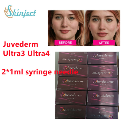 فیلر پوستی هیالورونیک اسید Juvederm Juvederm Lip Filler With  2x1ml Ultra3 Ultra4