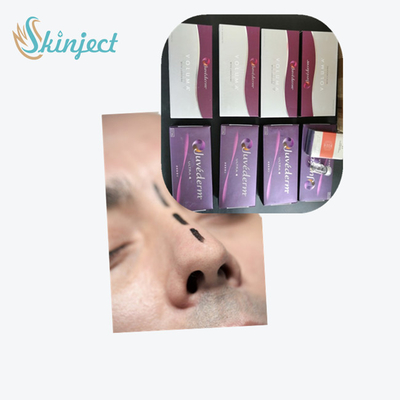 فیلر پوستی هیالورونیک اسید Juvederm Ultra3 برای لب ها