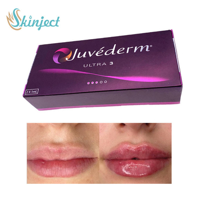 281ml هیالورونیک اسید فیلر لب Juvederm Ultra3 Dermal
