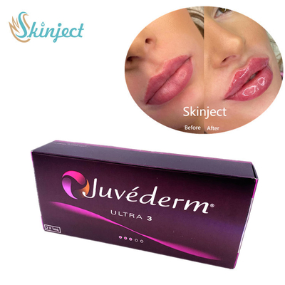 پرکننده های پوستی صورت Juvederm Ultra3 2x1ml هیالورونیک اسید