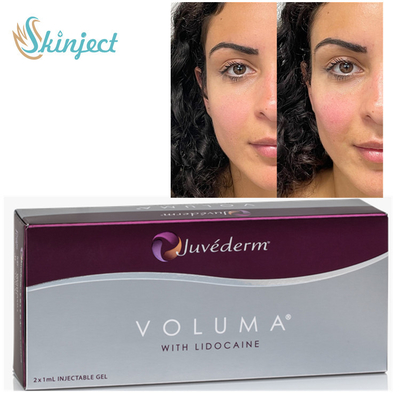 پرکننده های پوستی Juvederm Voluma 2x1ml هیالورونیک اسید برای استخوان گونه