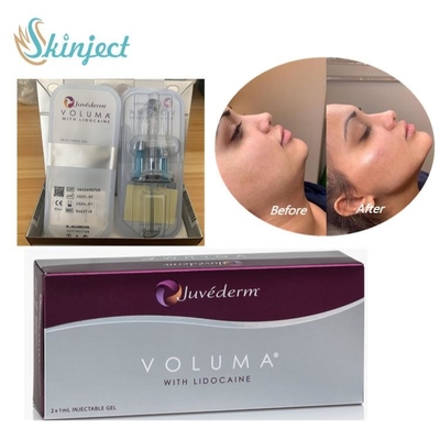 فیلر پوستی Juvederm Voluma هیالورونیک اسید برای کانتور چانه گونه گونه