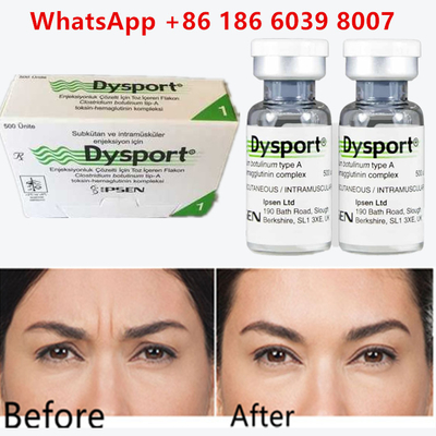 توکسین بوتولینوم نوع A 100 واحد Dysport  برای حذف استفاده
